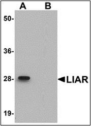 AP30506PU-N - ANKRD54 / LIAR