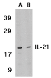 AP30413PU-N - Interleukin-21 / IL21
