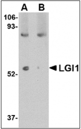 AP30497PU-N - LGI1 / EPT