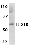 AP30414PU-N - Interleukin-21 receptor / IL21R