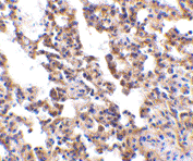 AP30414PU-N - Interleukin-21 receptor / IL21R