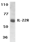 AP30416PU-N - IL22RA1 / IL22R