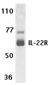 AP30417PU-N - IL22RA1 / IL22R