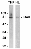 AP30438PU-N - IRAK1