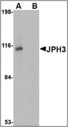 AP30471PU-N - Junctophilin-3 / JPH3