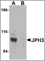 AP30470PU-N - Junctophilin-3 / JPH3