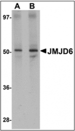 AP30464PU-N - JMJD6 / PTDSR