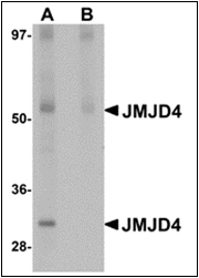 AP30462PU-N - JMJD4