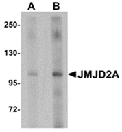 AP30460PU-N - JMJD2A / KDM4A