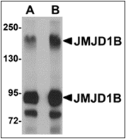 AP30458PU-N - JMJD1B / KDM3B