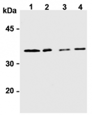 AM20177AF-N - Syntaxin 6 / STX6