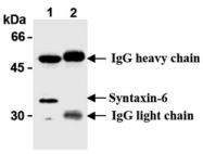 AM20177AF-N - Syntaxin 6 / STX6