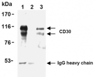 AM20190AF-N - CD30