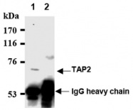 AM20195AF-N - ABCB3 / APT2 / TAP2