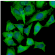 AM05641PU-N - Hexokinase
