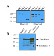 AM05641PU-N - Hexokinase