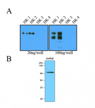 AM03129PU-S - Hexokinase-1/2