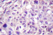 AP06071PU-N - MAP3K8 / TPL-2