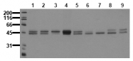 AM20216PU-N - GSK3 alpha/beta