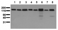 AM20218PU-N - HGF receptor