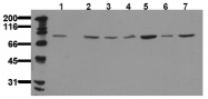 AM20219PU-N - PRKCQ / PRKCT