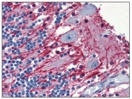 BM017 - Myelin Basic Protein
