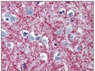 BM017 - Myelin Basic Protein