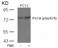 AP02534PU-S - PRKCQ / PRKCT