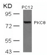 AP02782PU-S - PRKCQ / PRKCT