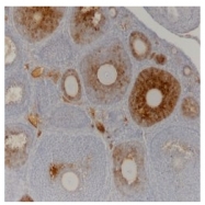 AM05878SU-N - Anti-Muellerian Hormone / AMH