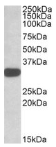 AP20167PU-N - TIP41-like protein (TIPRL)
