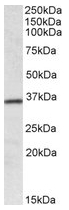 AP20173PU-N - HOXA4 / HOX1D