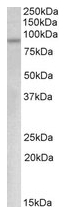 AP20174PU-N - MYB