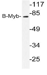 AP20206PU-N - Aurora kinase A