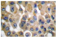 AP20194PU-N - Cyclooxygenase 2