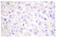 AP20195PU-N - CD324 / Cadherin-1