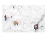 AP20199PU-N - Synaptophysin / SYP