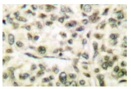 AP20202PU-N - GSK3 alpha
