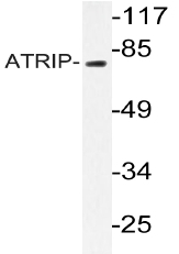 AP20204PU-N - ATRIP / AGS1