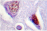 AP06579PU-N - Steroidogenic factor 1