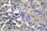 AP06206PU-N - Cytokeratin 8