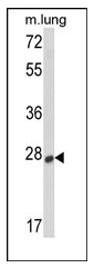 AP13236PU-N - Sclerostin / SOST