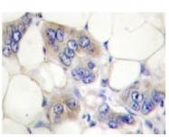 AP20330PU-N - Ah receptor / AhR