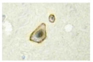 AP20542PU-N - Aromatase