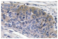 AP20578PU-N - Human IgG1