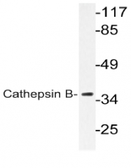 AP20651PU-N - Cathepsin B