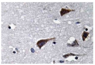 AP20651PU-N - Cathepsin B