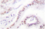 AP06354PU-N - THRB / ERBA2