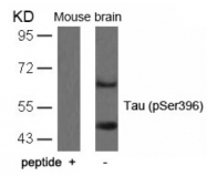 AP02394PU-S - MAPT / TAU