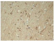 AP02394PU-S - MAPT / TAU